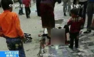 女明星炸断腿,演艺生涯面临重大挑战